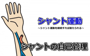 シャント運動