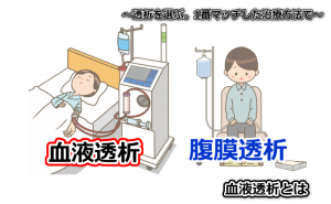 透析を選ぶ、血液透析か腹膜透析か